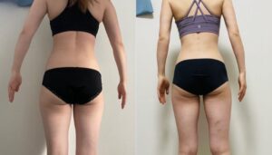 【麻布十番店がダイエット目的の方に多く選ばれる理由とは？】麻布十番店ならではの特徴をご紹介！