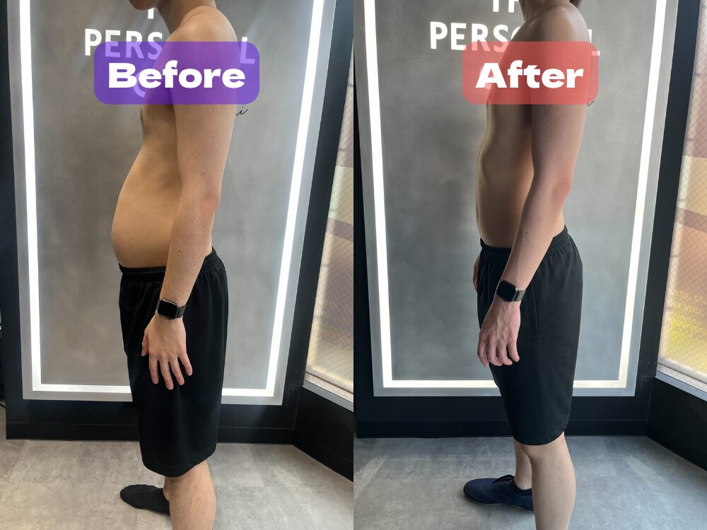２０代男性のビフォーアフター写真