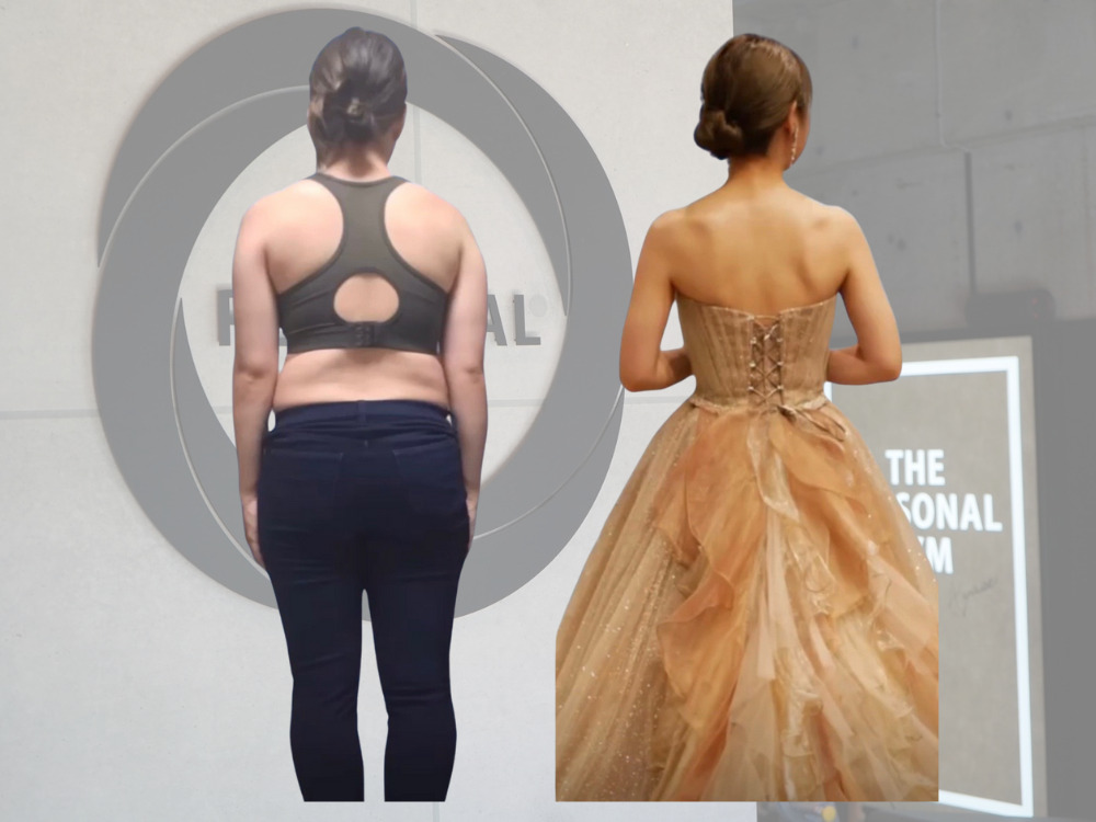 ダイエットした女性のBEFORE・AFTER