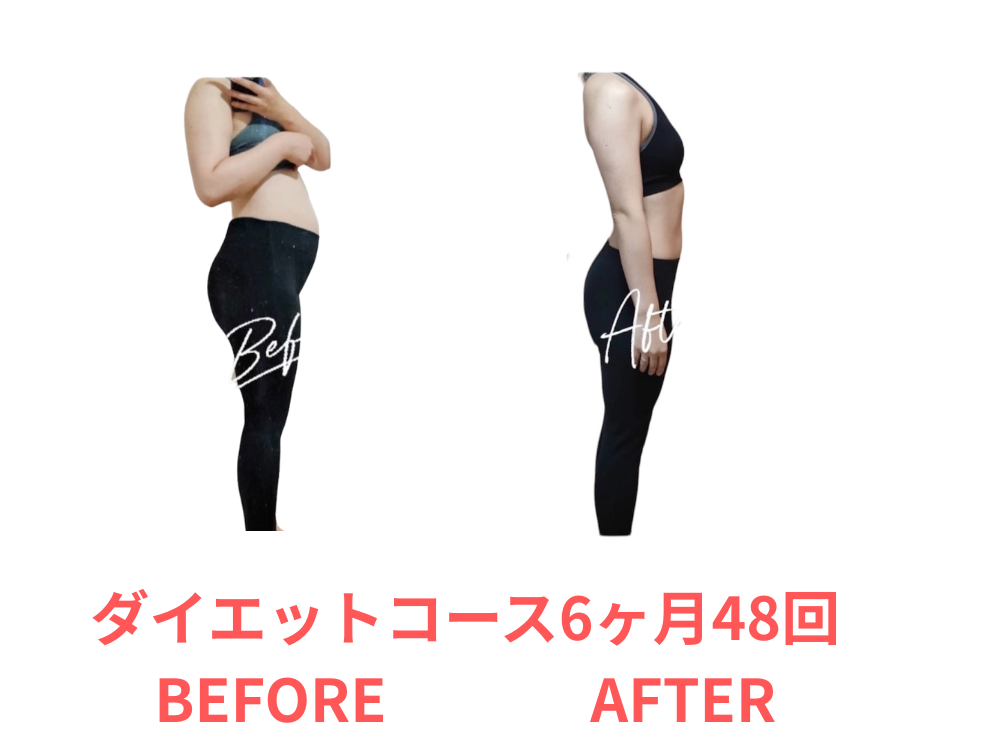 6ヶ月ダイエットをした女性のBEFORE・AFTER