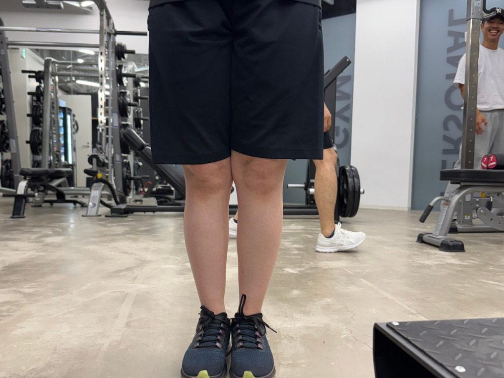 女性の脚のむくみの写真