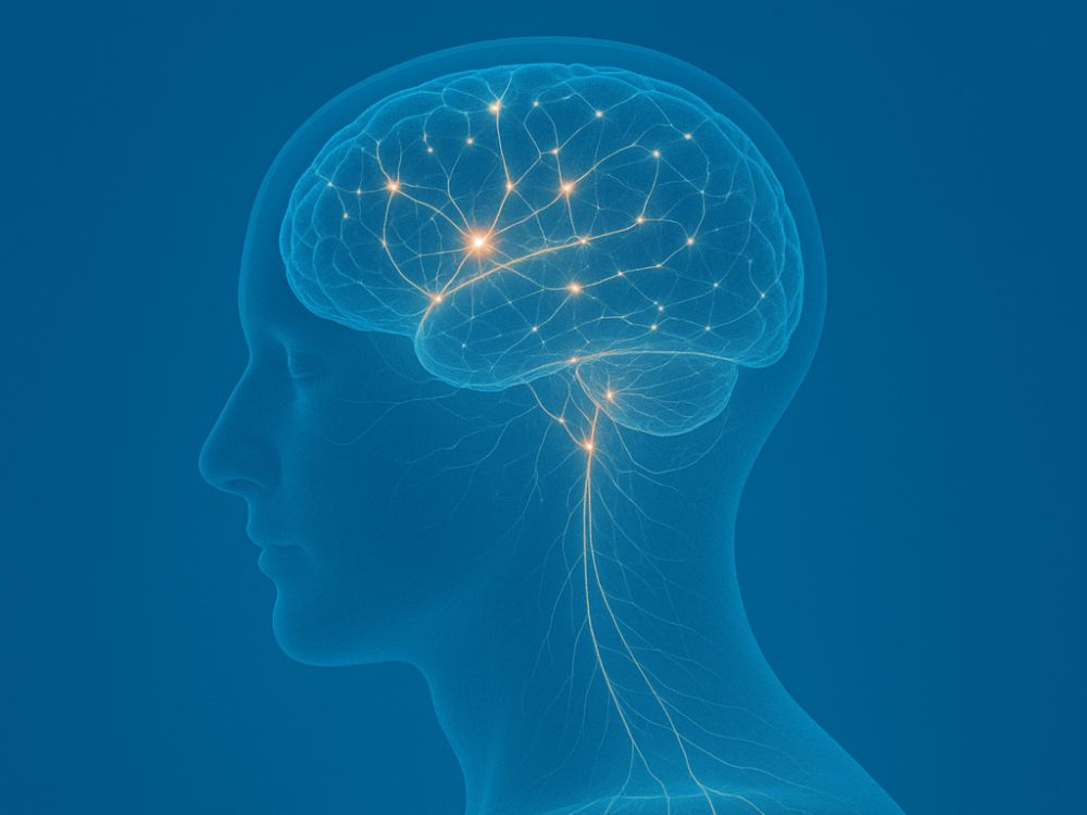 脳 画像