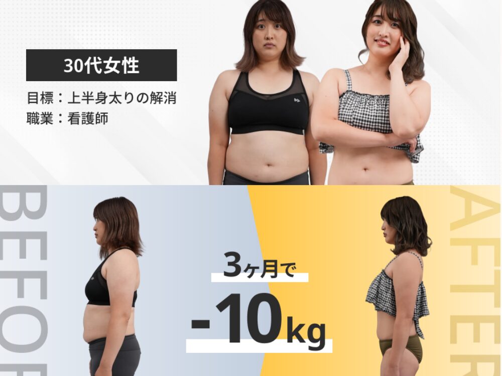 30代女性が-10kgしたBA写真