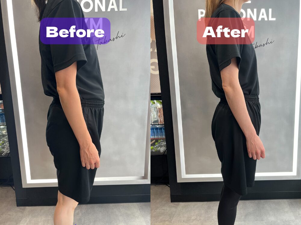 ３０代女性のビフォーアフター写真