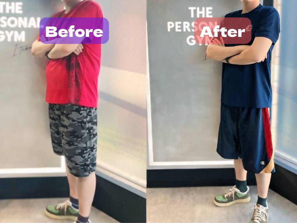 ２０代男性ビフォーアフター写真