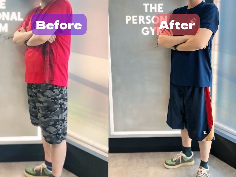 ２０代男性のビフォーアフター写真