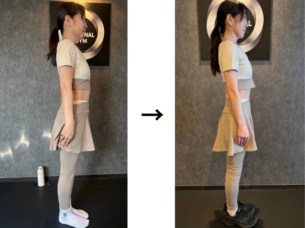 ビフォーアフター