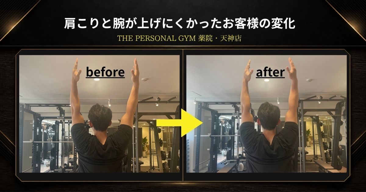 【薬院・天神店の姿勢改善実例】肩こりと腕の上げにくさ対応